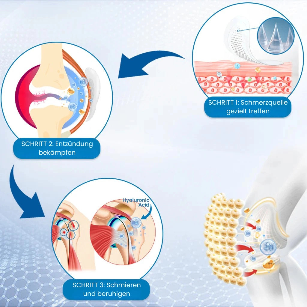 Microdarts-Pflaster zur Linderung von Gelenkschmerzen und Entzündungen.
